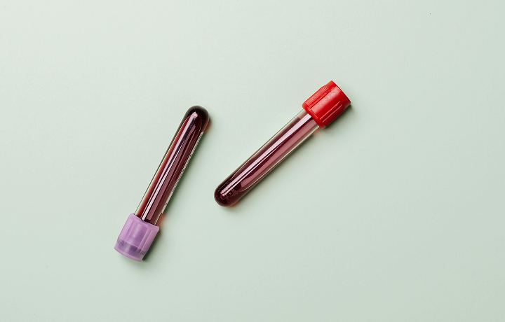 Is this the next big thing in medicine, or another failure?